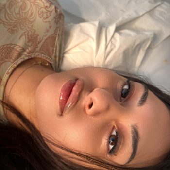 Lip filler8
